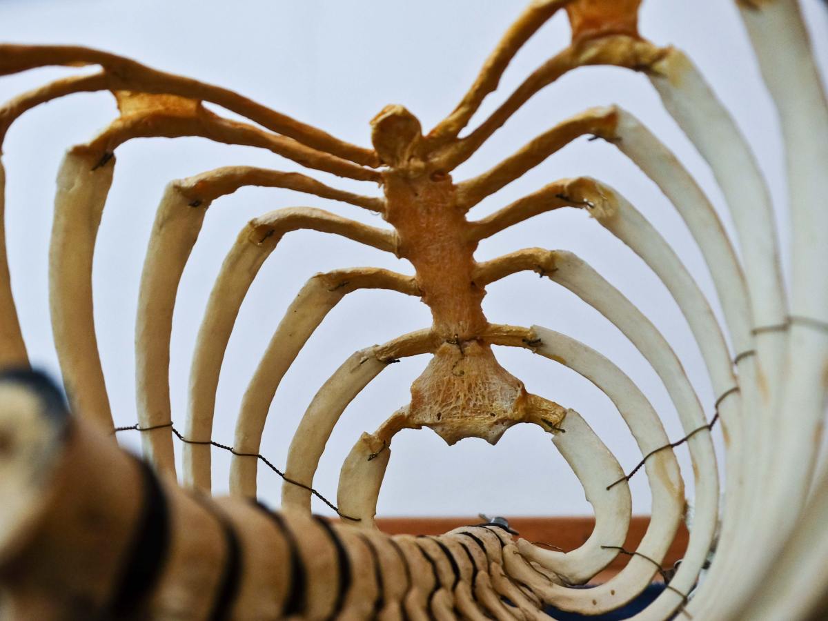 Entorse lombaire démocratique